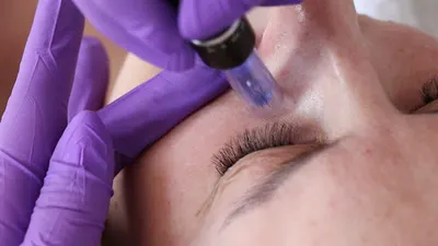 Studio Butterfly Kosmetologia estetyczna